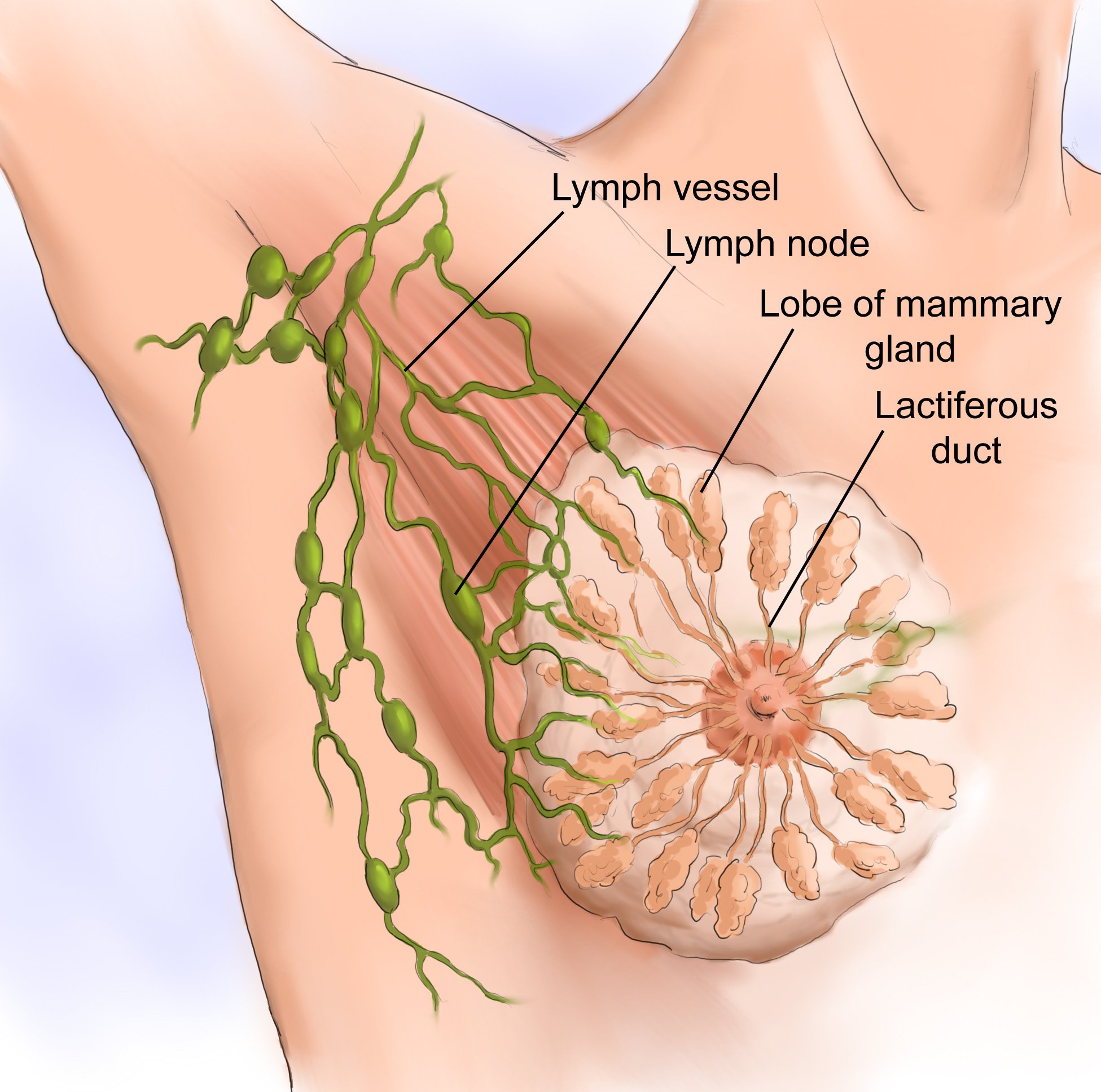 Wound Healing After Breast Cancer Surgery Triggers ...